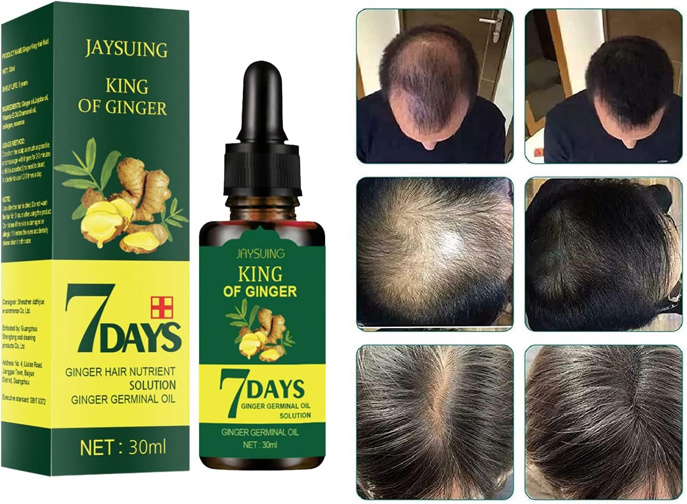 King of Ginger – Recupera tu Cabello en Semanas