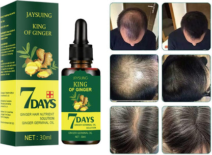 King of Ginger – Recupera tu Cabello en Semanas