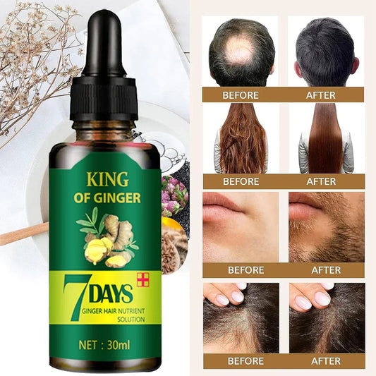 King of Ginger – Recupera tu Cabello en Semanas