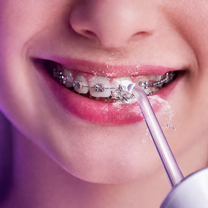 Irrigador Oral - Kit 4 Boquillas Gratis