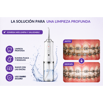 Irrigador Oral - Kit 4 Boquillas Gratis
